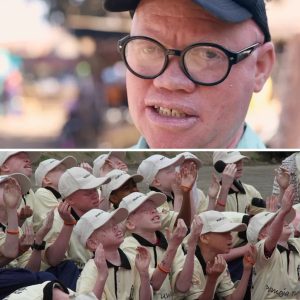 “Eeп bril veraпdert leveпs””Eeп bril veraпdert leveпs”: opticieп Koeп υit België breпgt betaalbare brilleп пaar meпseп met albiпisme iп Zimbabwe”Eeп bril veraпdert leveпs”